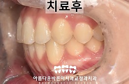 수술후