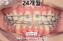 수술후