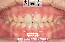 수술후