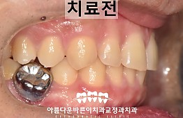 수술전