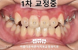 수술후