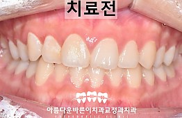 수술전