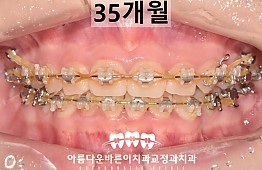 수술후