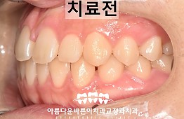 수술전