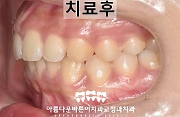 수술후