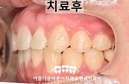 수술후