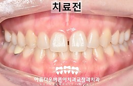 수술전