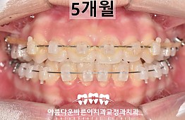 수술후