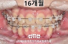 수술후