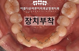 수술후