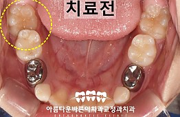 수술전