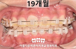 수술후