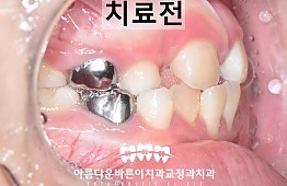 수술전