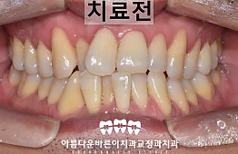 수술전