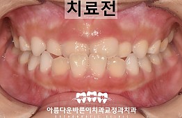 수술전