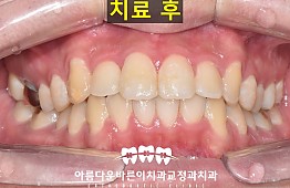 수술후