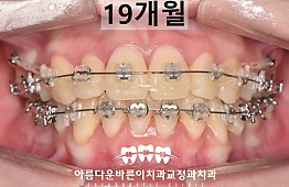 수술후