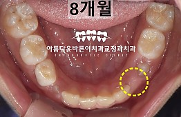 수술후