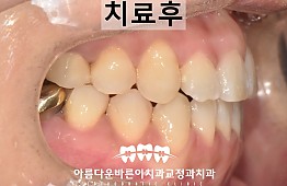 수술후