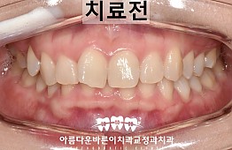 수술전