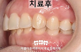 수술후