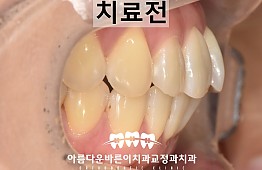 수술전