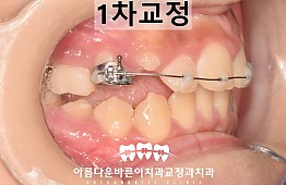 수술후