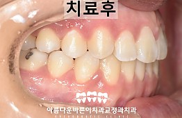 수술후