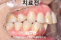 수술전