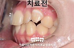 수술전