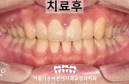 수술후