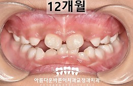 수술후