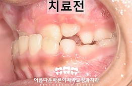 수술전