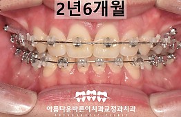 수술후