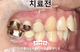 수술전