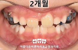 수술후