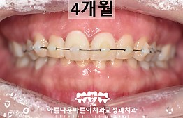 수술후