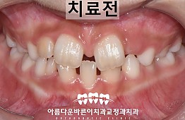 수술전