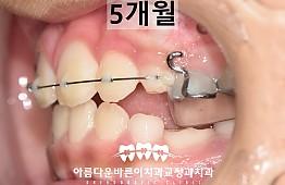 수술후