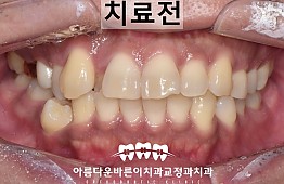 수술전