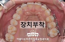 수술후