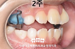 수술후