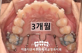 수술후