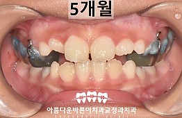 수술후