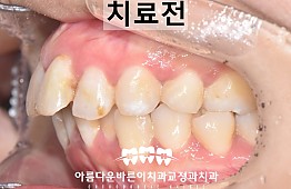 수술전