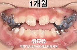 수술후