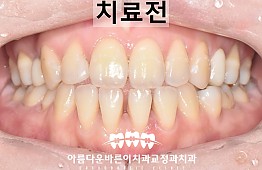 수술전