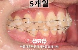 수술후