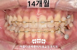 수술후