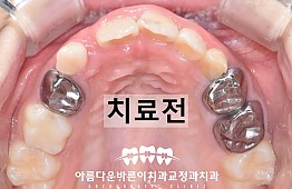 수술전